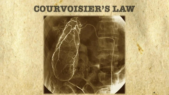 bai-viet/dinh-luat-courvoisier-trong-chan-doan-vang-da-va-benh-ly-tui-mat.html