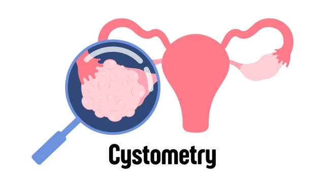 bai-viet/do-ap-luc-bang-quang-la-gi-khi-nao-can-thuc-hien.html