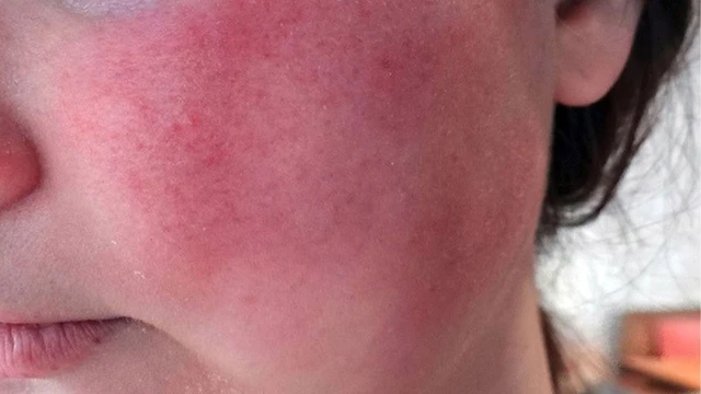 bai-viet/do-mat-khai-niem-nguyen-nhan-va-giai-phap-can-thiep.html