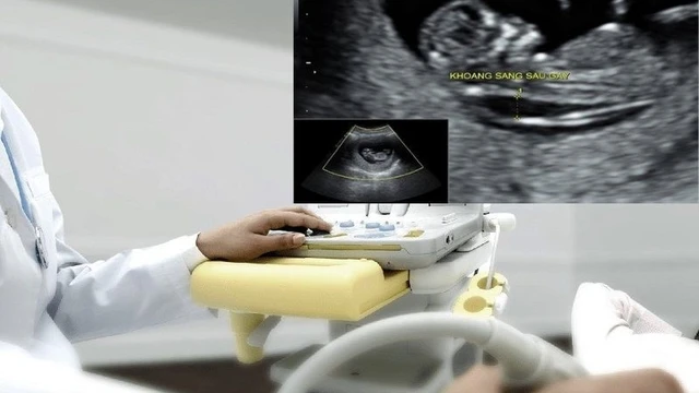 bai-viet/do-mo-da-gay-3-2mm-co-binh-thuong-khong.html