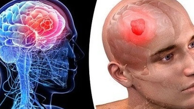 bai-viet/do-tuoi-bi-ung-thu-nao-la-bao-nhieu-tong-hop-cac-loai-ung-thu-theo-do-tuoi.html