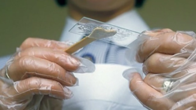 bai-viet/doc-ket-qua-soi-tuoi-huyet-trang-nhu-the-nao.html