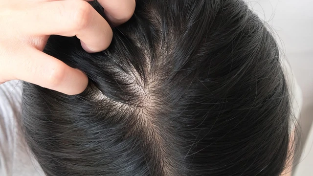 bai-viet/doi-moi-tren-da-dau-dau-hieu-nguyen-nhan-cach-dieu-tri-55586.html