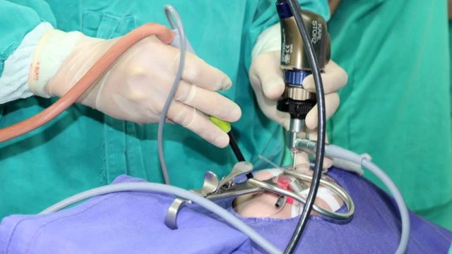 bai-viet/dot-cuon-mui-bang-song-cao-tan-khai-niem-phuong-phap-doi-tuong-va-luu-y.html