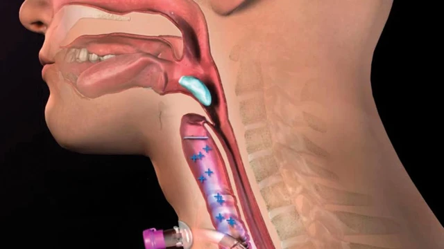 bai-viet/dot-quy-nuot-luoi-nguyen-nhan-dau-hieu-va-phuong-phap-so-cuu.html