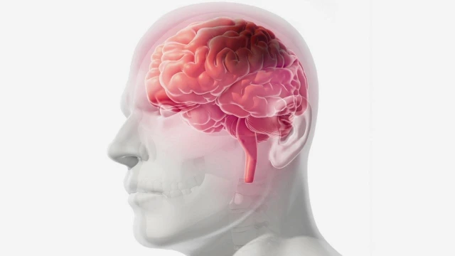 benh/dot-quy-thieu-mau-cuc-bo.html