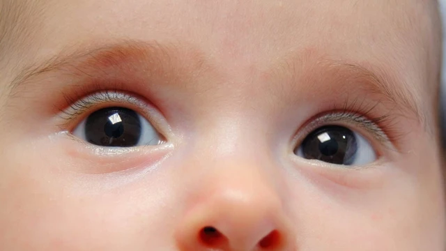 bai-viet/duc-thuy-tinh-the-o-tre-so-sinh-dieu-bo-me-can-biet.html