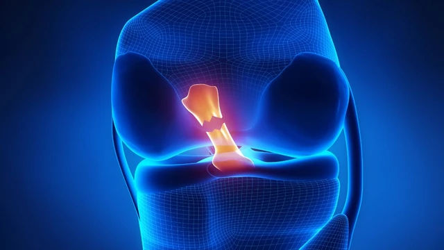 bai-viet/dut-day-chang-cheo-truoc-co-da-bong-duoc-khong-giai-dap-tu-chuyen-gia.html