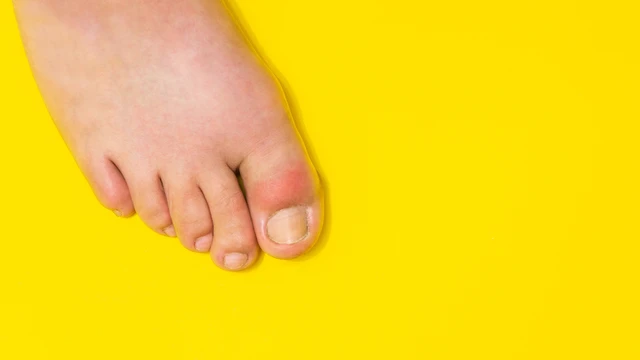 bai-viet/duy-tri-6-thoi-quen-hang-ngay-giup-giam-acid-uric.html