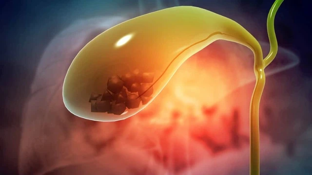 bai-viet/gall-bladder-la-gi-va-cac-benh-ly-thuong-gap-tai-gall-bladder.html