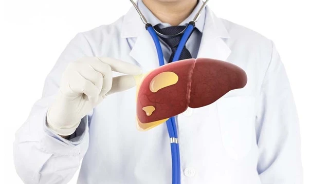 bai-viet/gan-nhiem-mo-do-1-la-gi-nguyen-nhan-va-cach-dieu-tri.html