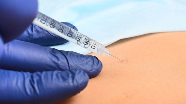 bai-viet/gay-te-khoang-cung-la-gi-bien-chung-co-the-xuat-hien.html