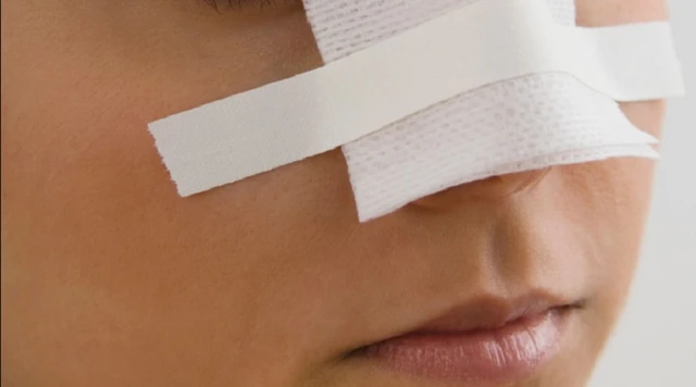 bai-viet/gay-xuong-mui-co-tu-lanh-khong-cach-chua-tri-nhu-the-nao.html