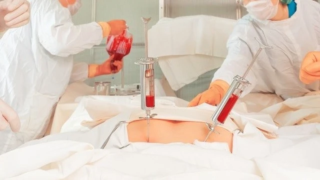 bai-viet/ghep-tuy-la-gi-nhung-dieu-can-luu-y-khi-ghep-tuy.html