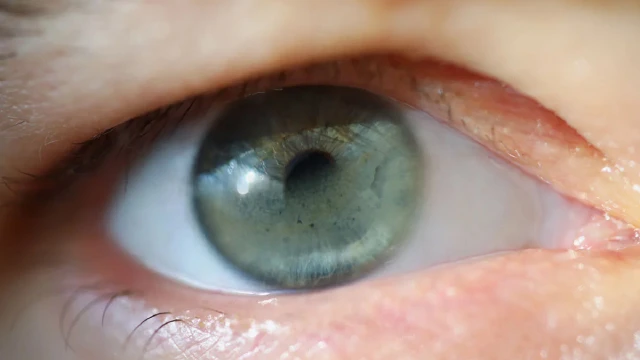 bai-viet/giac-mac-dai-bang-la-gi-dau-hieu-nhan-biet-va-nguyen-nhan-gay-benh.html