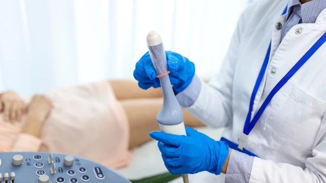 bai-viet/giai-dap-tac-hai-cua-sieu-am-dau-do-khi-canh-trung-la-gi-56946.html