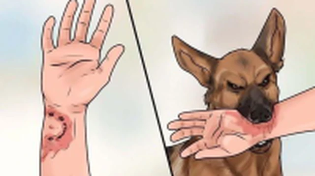 bai-viet/giai-dap-thac-mac-bi-cho-can-1-thang-co-tiem-phong-duoc-khong.html