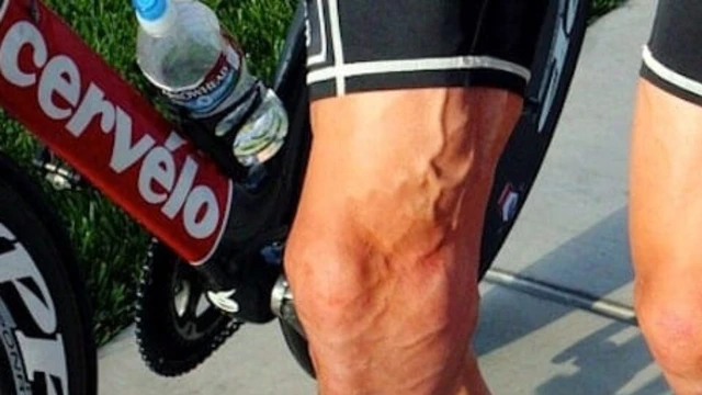 bai-viet/giai-dap-thac-mac-gian-tinh-mach-chan-co-nen-dap-xe.html