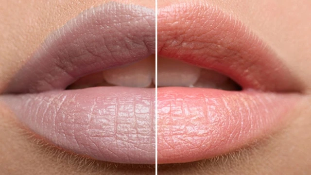 bai-viet/moi-tham-thieu-chat-gi-mot-so-yeu-to-khien-moi-tham.html