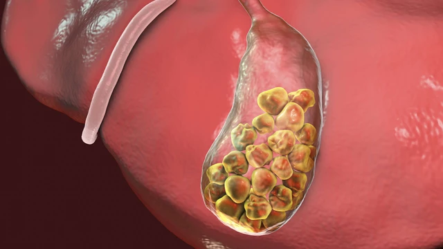 bai-viet/giai-dap-thac-mac-nguoi-bi-soi-mat-uong-canxi-duoc-khong.html