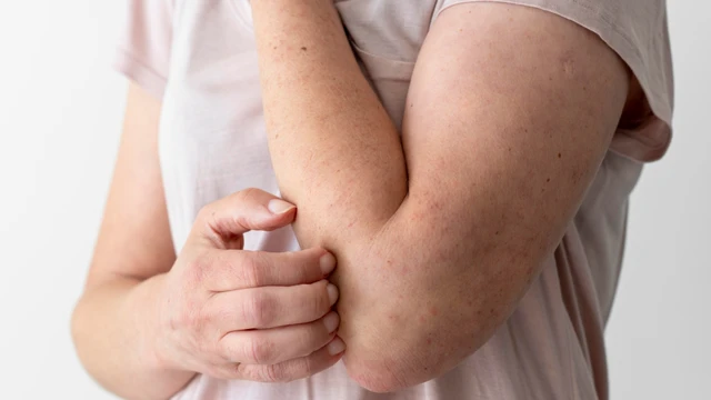 bai-viet/giai-dap-thac-mac-noi-me-day-co-duoc-nam-quat-khong.html