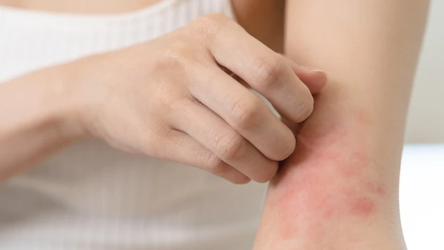 bai-viet/giai-dap-thac-mac-noi-me-day-co-duoc-tam-khong.html