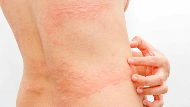 bai-viet/giai-dap-thac-mac-noi-me-day-co-nguy-hiem-khong.html