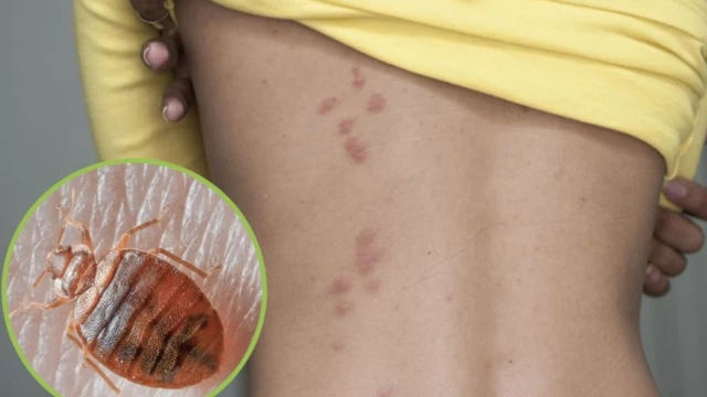 bai-viet/giai-dap-thac-mac-rep-giuong-can-co-nguy-hiem-khong.html