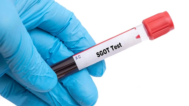 bai-viet/giai-dap-thac-mac-sgot-trong-xet-nghiem-mau-la-gi.html