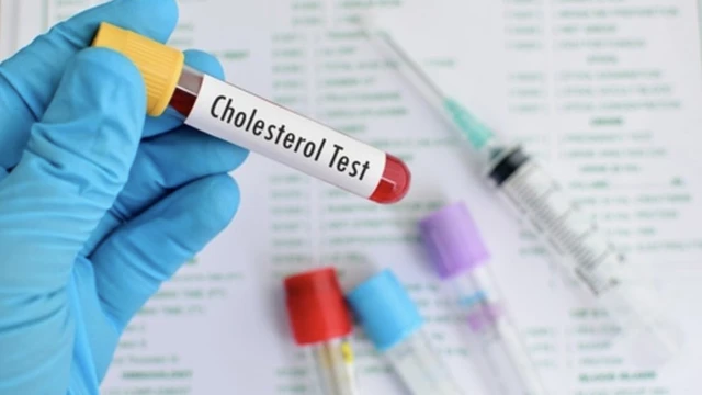 bai-viet/giai-dap-thac-mac-xet-nghiem-cholesterol-toan-phan-la-gi.html