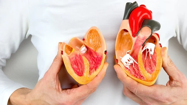 bai-viet/vi-sao-hep-van-2-la-gay-suy-tim-phai-su-khac-nhau-giua-suy-tim-phai-va-suy-tim-trai.html