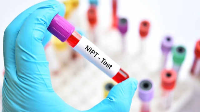 bai-viet/giai-dap-xet-nghiem-nipt-co-biet-duoc-trai-hay-gai-khong-65157.html