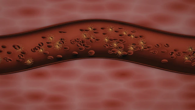 Giảm mỡ máu cao không dùng thuốc: Hướng dẫn kiểm soát an toàn từ lối sống