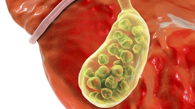 bai-viet/gian-duong-mat-nguyen-nhan-chan-doan-va-dieu-tri-benh.html