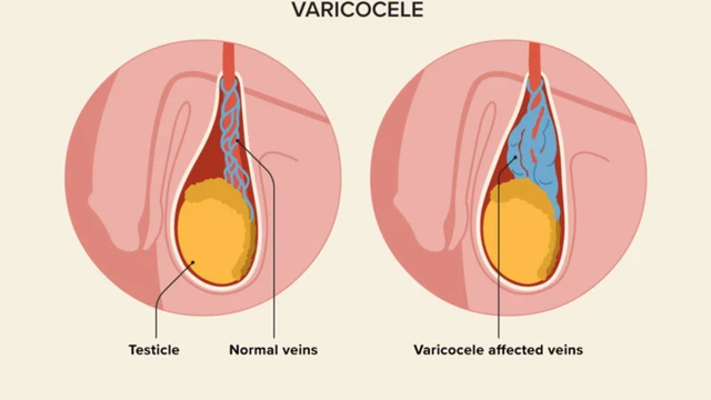 bai-viet/gian-tinh-mach-thung-tinh-co-nguy-hiem-khong.html