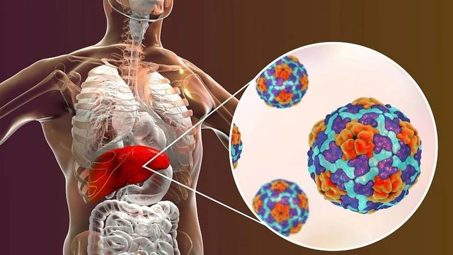 bai-viet/tim-hieu-ve-duong-lay-va-trieu-chung-cua-virus-viem-gan-e.html