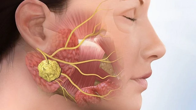 bai-viet/ung-thu-xuong-ham-co-chua-duoc-khong-1.html