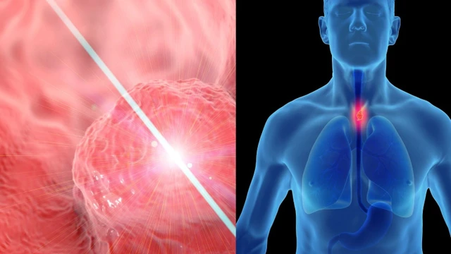 bai-viet/goc-giai-dap-ung-thu-thuc-quan-co-nen-mo-khong-loi-hay-hai-nhieu-hon.html