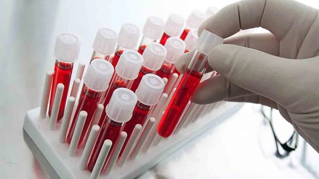 bai-viet/goc-giai-dap-xet-nghiem-canxi-mau-co-loi-ich-gi.html