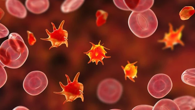 bai-viet/giam-tieu-cau-co-phai-la-ung-thu-mau-cach-phong-ngua-giam-tieu-cau.html