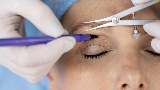 bai-viet/goc-thac-mac-lay-mo-thua-mi-mat-tren-co-tac-dung-gi.html