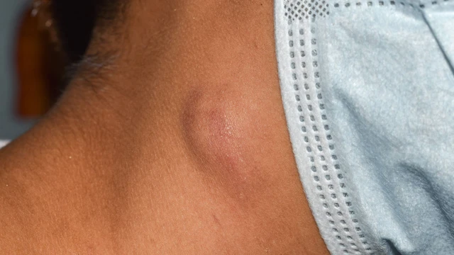 bai-viet/hach-lanh-tinh-co-dau-khong-dac-diem-nhan-biet-hach-lanh-tinh.html