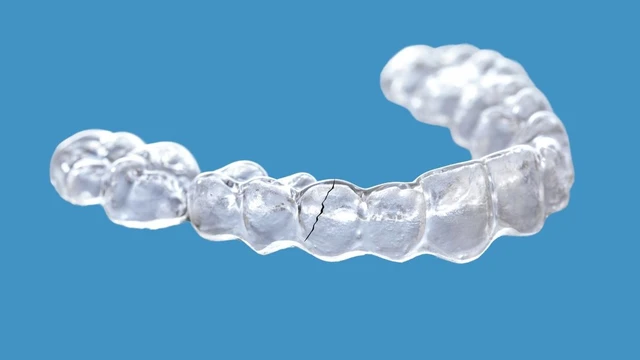 bai-viet/ham-duy-tri-trong-suot-bi-nut-do-dau-xu-ly-nhu-the-nao.html