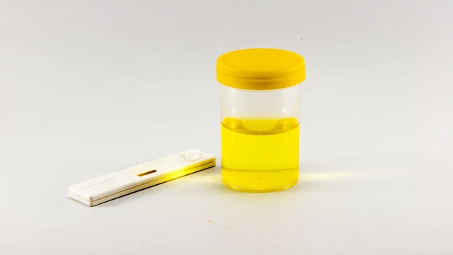 bai-viet/he-so-thanh-thai-creatinin-la-gi-cong-thuc-tinh-he-so-thanh-thai-creatinin-ra-sao.html