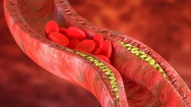 bai-viet/hep-mach-vanh-trieu-chung-phan-loai-va-muc-do-nguy-hiem.html