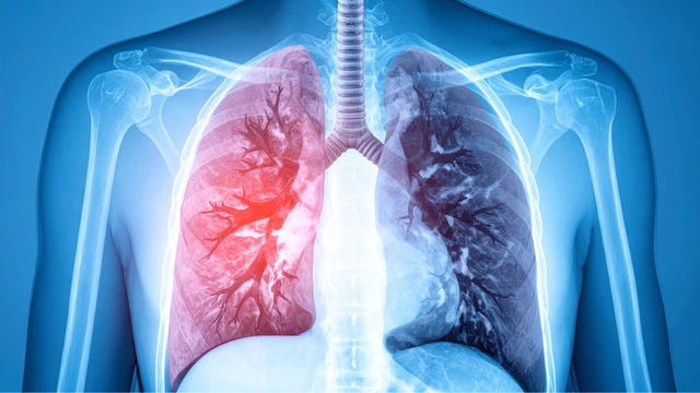 bai-viet/hep-tinh-mach-phoi-la-gi-nguyen-nhan-dau-hieu-va-cach-dieu-tri.html