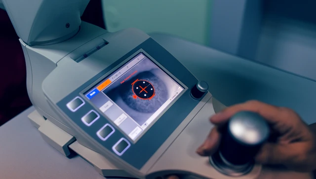 bai-viet/hien-giac-mac-la-gi-nhung-thong-tin-co-ban-ve-viec-hien-giac-mac.html