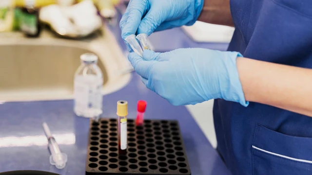 bai-viet/goc-thac-mac-xet-nghiem-ky-sinh-trung-bao-nhieu-tien.html