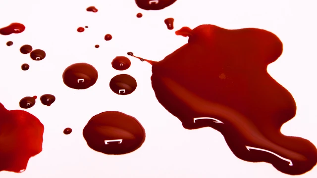 bai-viet/hien-tuong-bang-huyet-sau-sinh-1-thang-la-gi-phai-lam-gi-de-phong-bang-huyet-sau-sinh.html