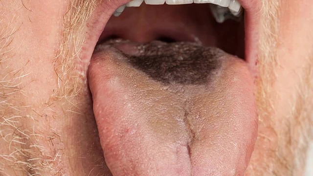 bai-viet/hien-tuong-luoi-co-dom-den-nho-can-nguyen-cach-xu-tri-va-phong-ngua-1.html